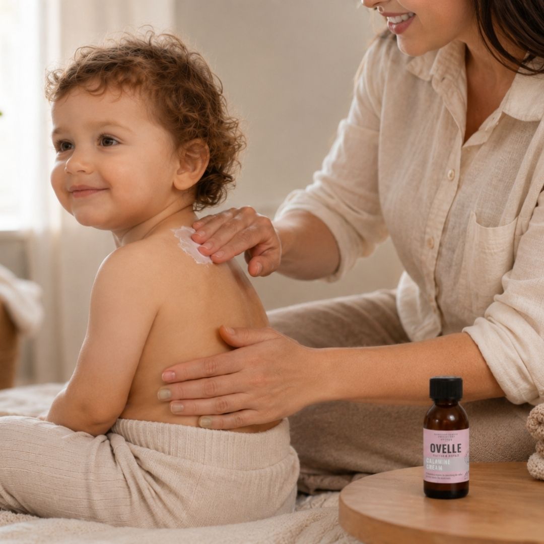 Ovelle Calamine Cream käyttö vesirokon yhteydessä kutisevalla iholla